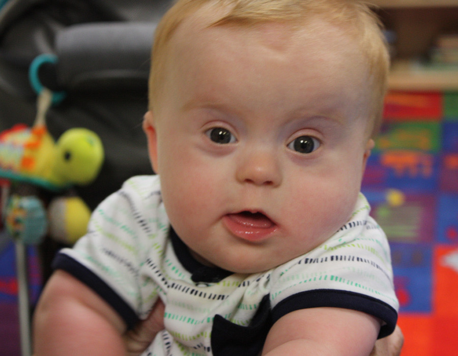 A white baby boy with Down syndrome with red hair looking at the camera and smiling.